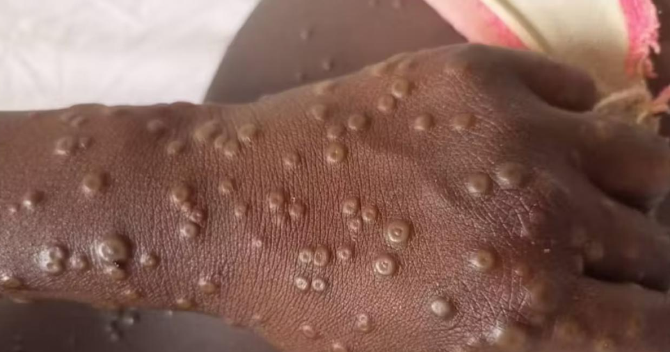 Capture d’écran 2025-09-25 144214