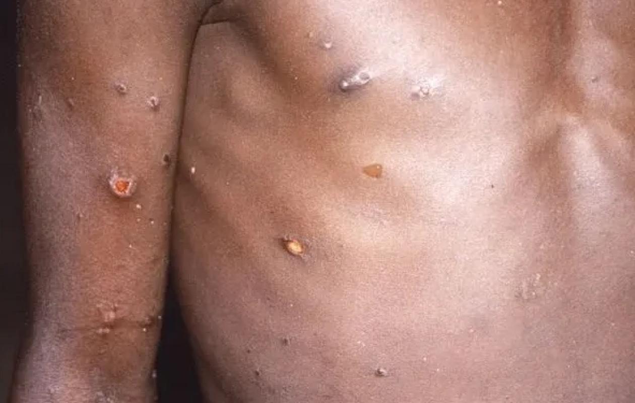 thumb_1260x800_68d2f1dc267a0_VYuFQf2hCX